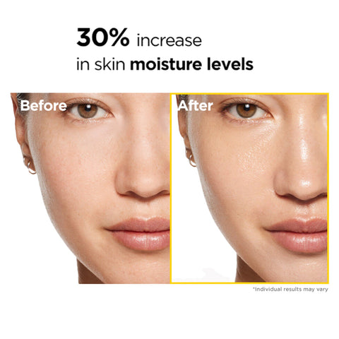 EASYDEW Multy Vita C Serum 14ml – Корейская косметика с ниацинамидом и пептидами. Заказать на LOVU.md с доставкой по Молдове.