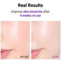 ISNTREE Hyper Retinol EX 1.0 – ser coreean pentru reducerea ridurilor. Cumpără K-Beauty Box pe LOVU.md