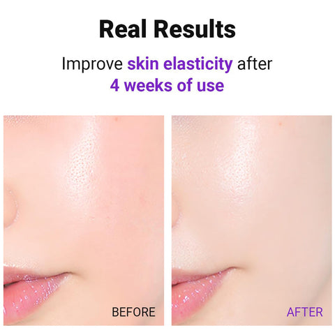 ISNTREE Hyper Retinol EX 1.0 – ser coreean pentru reducerea ridurilor. Cumpără K-Beauty Box pe LOVU.md