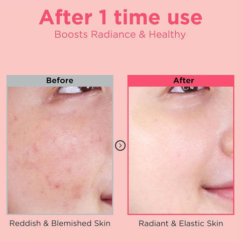 EASYDEW DW-EGF Re-DERMA Master – антивозрастная ампула с пептидом EGF. Доставка по Молдове от LOVU.md