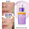 PURITO SEOUL Retinol Retinal 2000 NAD+ Serum – cosmetice coreene Moldova